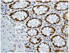 Immunohistochemistry (Formalin/PFA-fixed paraffin-embedded sections) - Anti-MCM3 antibody [EPR7080] - BSA and Azide free (AB248222), expandable thumbnail