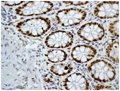 Immunohistochemistry (Formalin/PFA-fixed paraffin-embedded sections) - Anti-MCM3 antibody [EPR7080] - BSA and Azide free (AB248222)