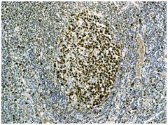 Immunohistochemistry (Formalin/PFA-fixed paraffin-embedded sections) - Anti-MCM3 antibody [EPR7080] - BSA and Azide free (AB248222), expandable thumbnail