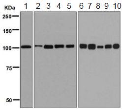 Western blot - Anti-MCM3 antibody [EPR7080] - BSA and Azide free (AB248222), expandable thumbnail
