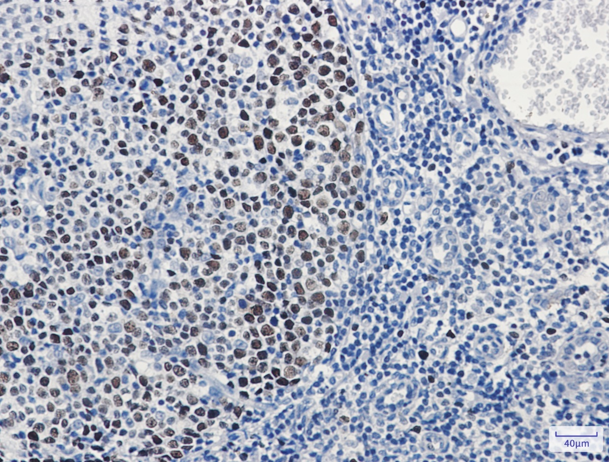 Immunohistochemistry (Formalin/PFA-fixed paraffin-embedded sections) - Anti-MCM3 Antibody [S04-6B9] (AB317372), expandable thumbnail