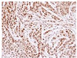 Immunohistochemistry (Formalin/PFA-fixed paraffin-embedded sections) - Anti-MCM4 antibody (AB154315)