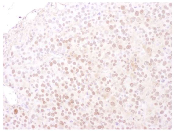 Immunohistochemistry (Formalin/PFA-fixed paraffin-embedded sections) - Anti-MCM4 antibody (AB3728), expandable thumbnail