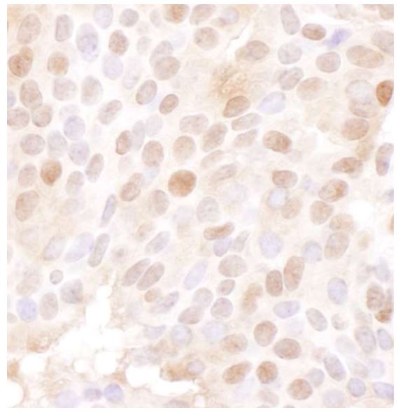Immunohistochemistry (Formalin/PFA-fixed paraffin-embedded sections) - Anti-MCM4 antibody (AB3728), expandable thumbnail