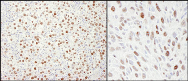 Immunohistochemistry (Formalin/PFA-fixed paraffin-embedded sections) - Anti-MCM4 antibody (AB4459), expandable thumbnail