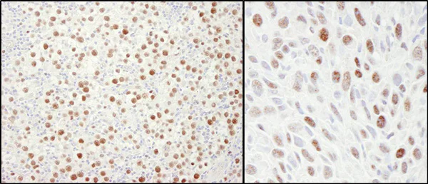 Immunohistochemistry (Formalin/PFA-fixed paraffin-embedded sections) - Anti-MCM4 antibody (AB4459)