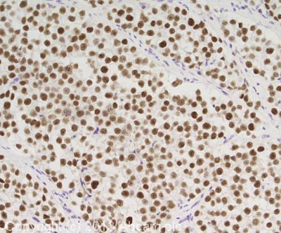 Immunohistochemistry (Formalin/PFA-fixed paraffin-embedded sections) - Anti-MCM4 antibody (AB4459), expandable thumbnail