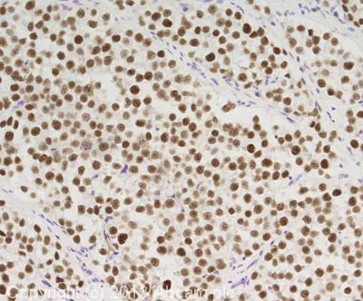 Immunohistochemistry (Formalin/PFA-fixed paraffin-embedded sections) - Anti-MCM4 antibody (AB4459)
