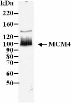 Western blot - Anti-MCM4 antibody (AB4459), expandable thumbnail