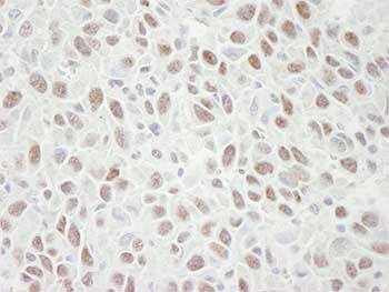 Immunohistochemistry (Formalin/PFA-fixed paraffin-embedded sections) - Anti-MCM4 antibody (AB84153), expandable thumbnail