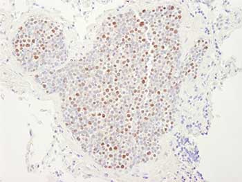 Immunohistochemistry (Formalin/PFA-fixed paraffin-embedded sections) - Anti-MCM4 antibody (AB84153), expandable thumbnail