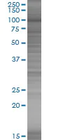 SDS-PAGE - MCM4 overexpression 293T lysate (whole cell) (AB94302)