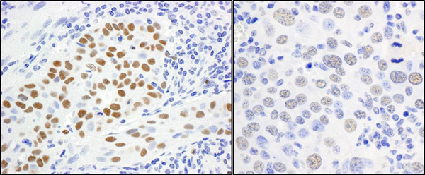 Immunohistochemistry (Formalin/PFA-fixed paraffin-embedded sections) - Anti-MCM5 antibody (AB17967), expandable thumbnail