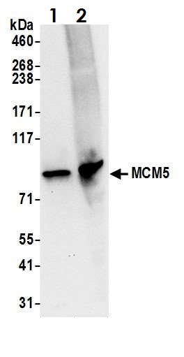 Western blot - Anti-MCM5 antibody (AB17967), expandable thumbnail