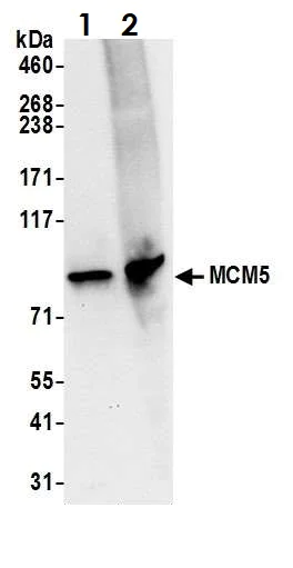 Western blot - Anti-MCM5 antibody (AB17967)
