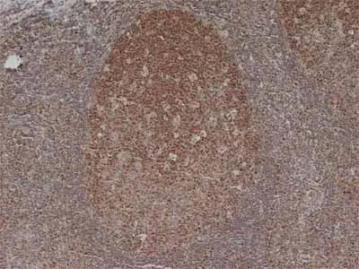 Immunohistochemistry (Formalin/PFA-fixed paraffin-embedded sections) - Anti-MCM5 antibody [CRCT5.1 (A2.7A3)] (AB6154)