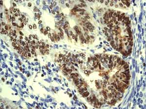 Immunohistochemistry (Formalin/PFA-fixed paraffin-embedded sections) - Anti-MCM5 antibody [EP2682Y] (ab76023), expandable thumbnail