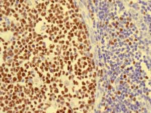Immunohistochemistry (Formalin/PFA-fixed paraffin-embedded sections) - Anti-MCM5 antibody [EP2682Y] (AB76023), expandable thumbnail