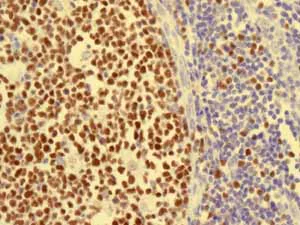 Immunohistochemistry (Formalin/PFA-fixed paraffin-embedded sections) - Anti-MCM5 antibody [EP2682Y] (AB76023)