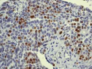 Immunohistochemistry (Formalin/PFA-fixed paraffin-embedded sections) - Anti-MCM5 antibody [EP2682Y] (ab76023), expandable thumbnail