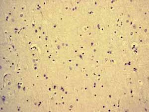 Immunohistochemistry (Formalin/PFA-fixed paraffin-embedded sections) - Anti-MCM5 antibody [EP2682Y] (AB76023)