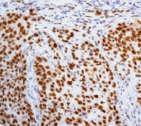Immunohistochemistry (Formalin/PFA-fixed paraffin-embedded sections) - Anti-MCM5 antibody [EP2682Y] (AB76023), expandable thumbnail