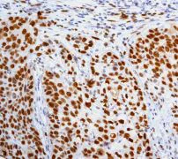 Immunohistochemistry (Formalin/PFA-fixed paraffin-embedded sections) - Anti-MCM5 antibody [EP2682Y] (AB76023)