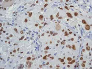 Immunohistochemistry (Formalin/PFA-fixed paraffin-embedded sections) - Anti-MCM5 antibody [EP2682Y] - BSA and Azide free (AB284735)