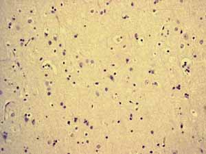 Immunohistochemistry (Formalin/PFA-fixed paraffin-embedded sections) - Anti-MCM5 antibody [EP2682Y] - BSA and Azide free (AB284735), expandable thumbnail