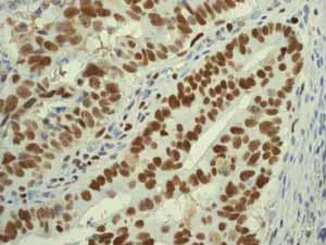 Immunohistochemistry (Formalin/PFA-fixed paraffin-embedded sections) - Anti-MCM5 antibody [EP2682Y] - BSA and Azide free (AB284735)
