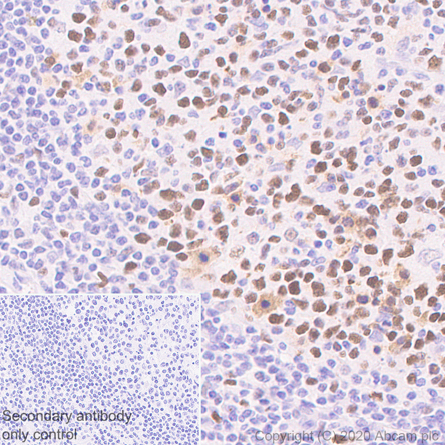 Immunohistochemistry (Formalin/PFA-fixed paraffin-embedded sections) - Anti-MCM5 antibody [EP2683Y] (AB75975), expandable thumbnail