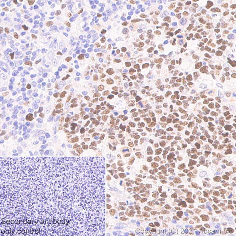 Immunohistochemistry (Formalin/PFA-fixed paraffin-embedded sections) - Anti-MCM6 antibody [1/MCM6] - BSA and Azide free (AB280215)