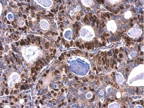 Immunohistochemistry (Formalin/PFA-fixed paraffin-embedded sections) - Anti-MCM6 antibody (AB184147)