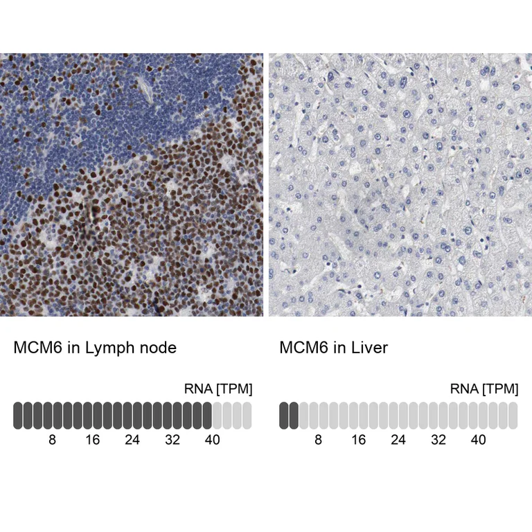 Immunohistochemistry (Formalin/PFA-fixed paraffin-embedded sections) - Anti-MCM6 Antibody (AB327184)