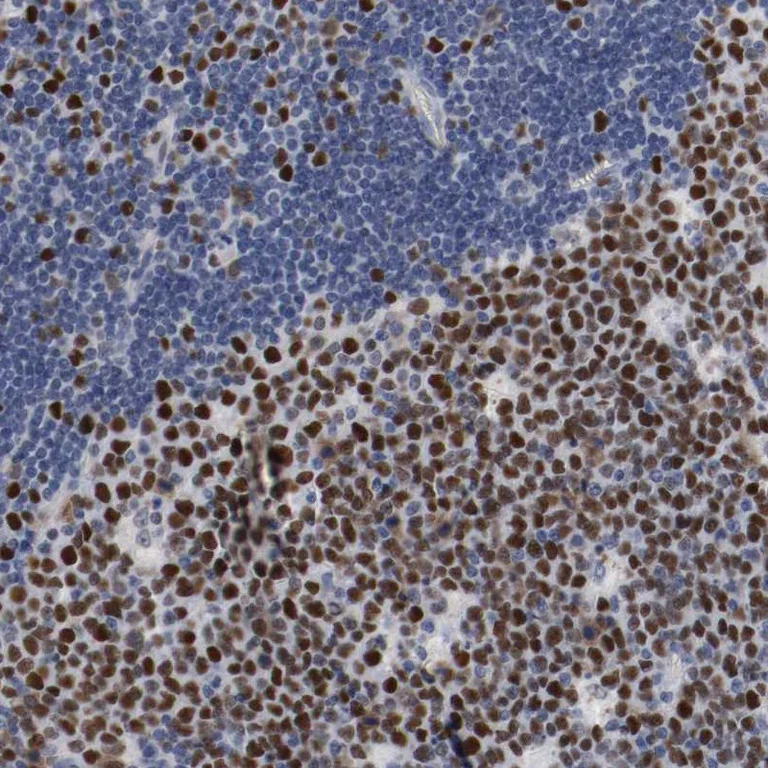 Immunohistochemistry (Formalin/PFA-fixed paraffin-embedded sections) - Anti-MCM6 Antibody (AB327184)