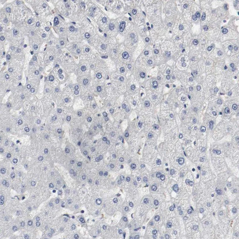 Immunohistochemistry (Formalin/PFA-fixed paraffin-embedded sections) - Anti-MCM6 Antibody (AB327184)