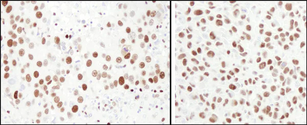 Immunohistochemistry (Formalin/PFA-fixed paraffin-embedded sections) - Anti-MCM6 antibody (AB4458)