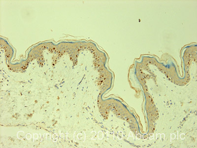 Immunohistochemistry (Formalin/PFA-fixed paraffin-embedded sections) - Anti-MCM6 antibody (AB4458)