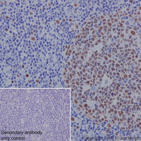 Immunohistochemistry (Formalin/PFA-fixed paraffin-embedded sections) - Anti-MCM6 antibody [EPR17686] (AB201683), expandable thumbnail