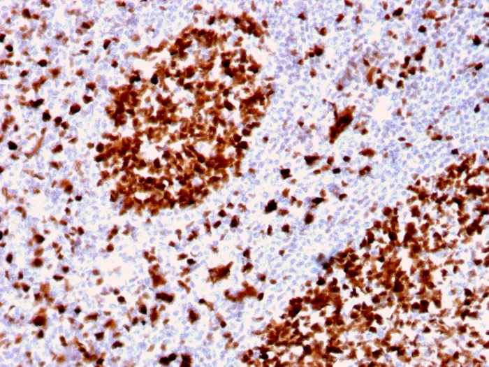 Immunohistochemistry (Formalin/PFA-fixed paraffin-embedded sections) - Anti-MCM6 antibody [MCM6/2999] (AB268083)
