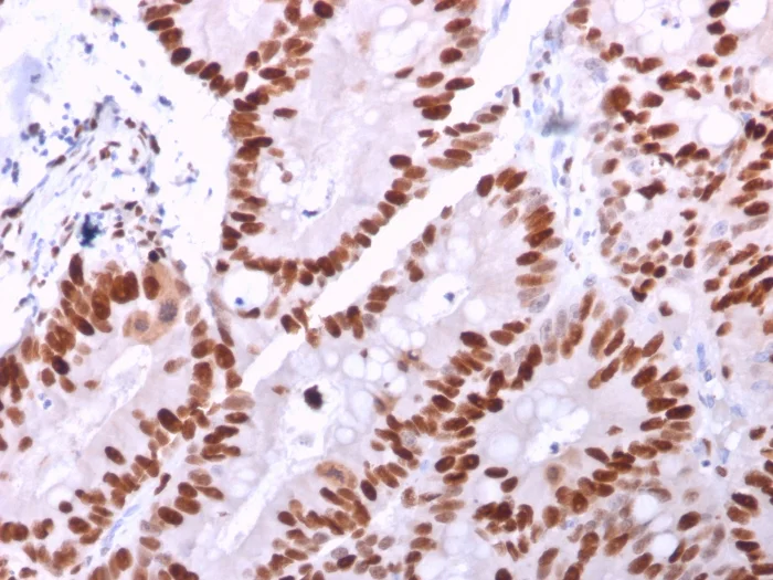 Immunohistochemistry (Formalin/PFA-fixed paraffin-embedded sections) - Anti-MCM6 antibody [MCM6/2999] (AB268083)