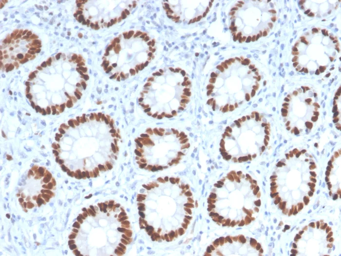 Immunohistochemistry (Formalin/PFA-fixed paraffin-embedded sections) - Anti-MCM6 antibody [MCM6/2999] (AB268083)