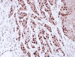 Immunohistochemistry (Formalin/PFA-fixed paraffin-embedded sections) - Anti-MCM7/PRL antibody (AB96849)