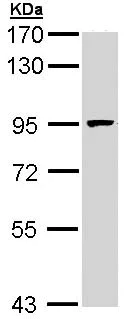 Western blot - Anti-MCM7/PRL antibody (AB96849)