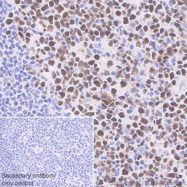 Immunohistochemistry (Formalin/PFA-fixed paraffin-embedded sections) - Anti-MCM7/PRL antibody [EP1974Y] - BSA and Azide free (AB242382)