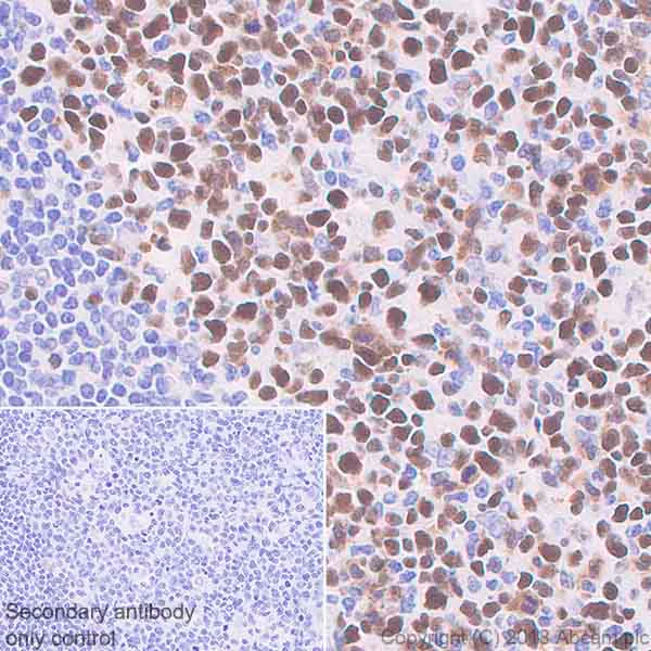 Immunohistochemistry (Formalin/PFA-fixed paraffin-embedded sections) - Anti-MCM7/PRL antibody [EP1974Y] - BSA and Azide free (AB242382)