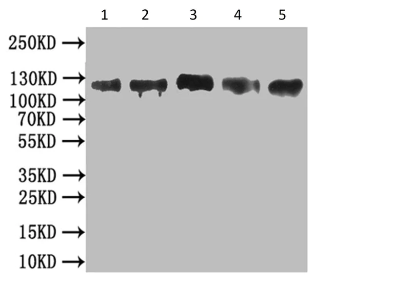 Western blot - Anti-MCM9 antibody (AB235335)