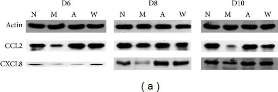 Western blot - Anti-MCP1 antibody (AB7202)