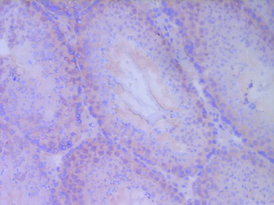 Immunohistochemistry (Frozen sections) - Anti-MCP1 antibody [ECE.2] (AB8101)