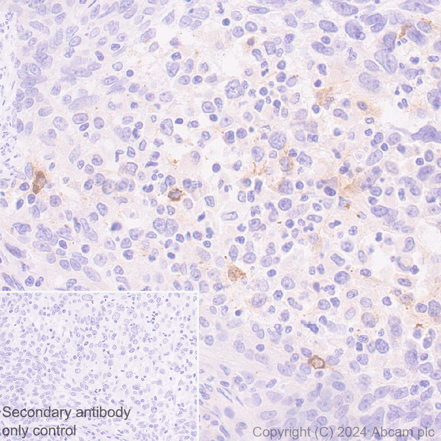 Immunohistochemistry (Formalin/PFA-fixed paraffin-embedded sections) - Anti-MCP1 antibody [EPR21025] - BSA and Azide free (ab242013), expandable thumbnail
